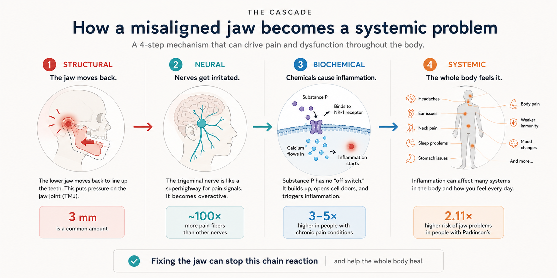 A four-step cascade diagram showing how a misaligned jaw can drive pain and dysfunction throughout the body: structural jaw retrusion, neural irritation, biochemical inflammation, and systemic effects.